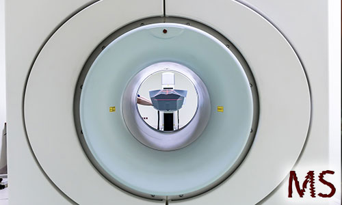 Multiple Sklerose Magnetresonanztomographie